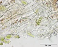 植物の細胞壁の顕微鏡写真