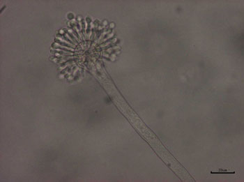 写真-2　Aspergillus 属