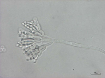 写真-3　Penicillium 属