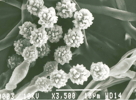 図2 分生子形成細胞から数珠状につくられるコウジカビの分生子 走査型電子顕微鏡写真